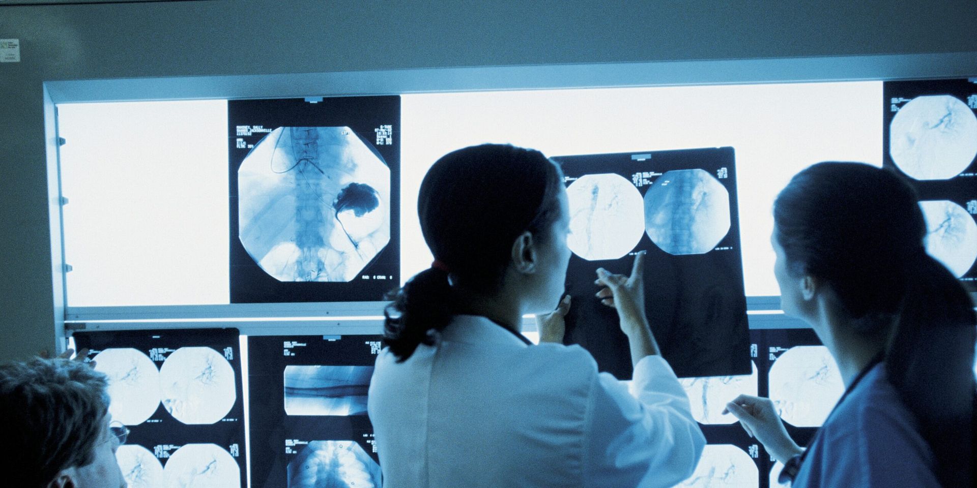 U.S. Cancer Screening Research Advances Amid Shutdown Disruptions