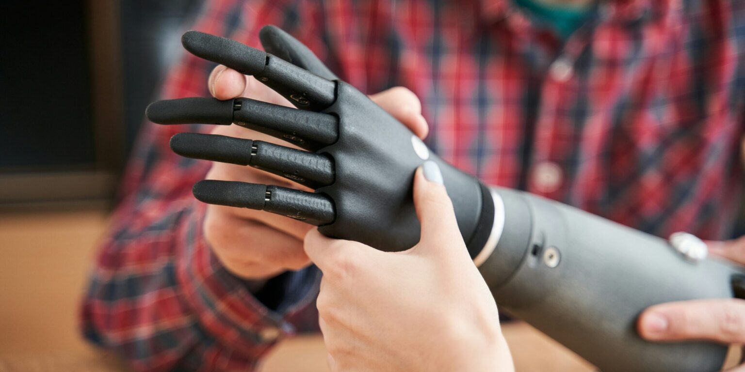 Missouri Develops Groundbreaking Prosthetics Capable of Sensory Feedback